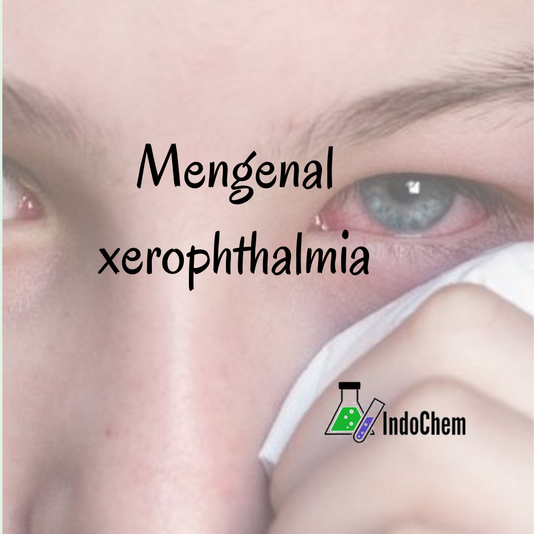 Mengenal Xerophthalmia Dengan Indochem